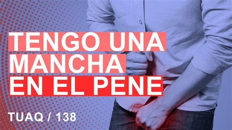 manchas en el pen negras|Las manchas negras en el pene podrían ser un cáncer